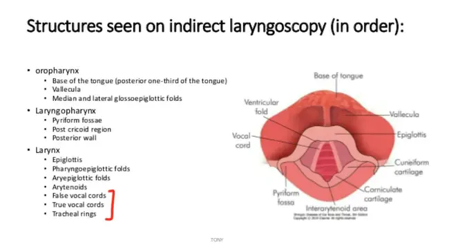 Laryngealization : 喉部成形术