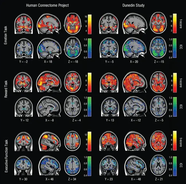 Brain Function Assessment Form : 脑功能评估表