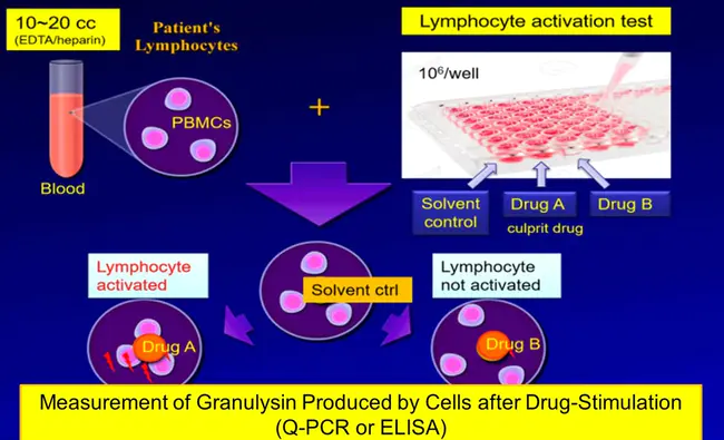 Drug Lymphocyte Stimulation Test : 药物淋巴细胞刺激试验