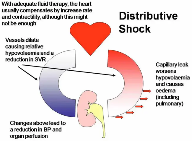 Shock Induced Oscillation : 冲击引起的振荡