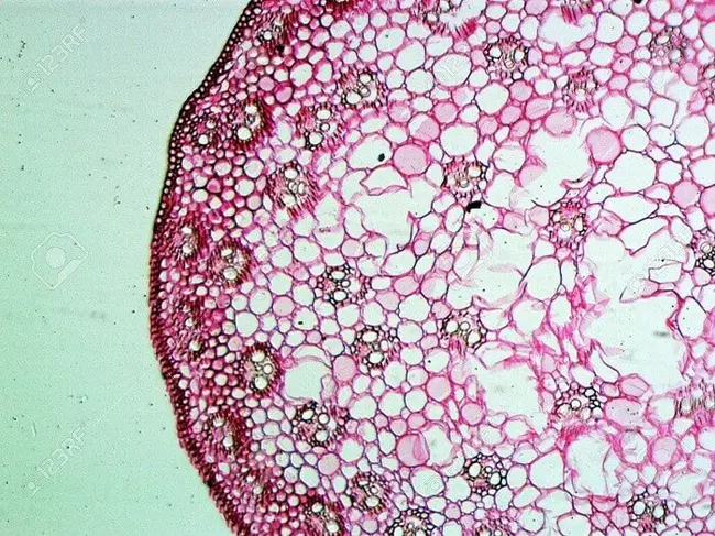 Parenchymal Junctional Line : 实质连接线