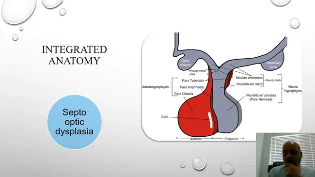 Pituitary Pars Intermedia Dysfunction : 垂体中间部功能障碍