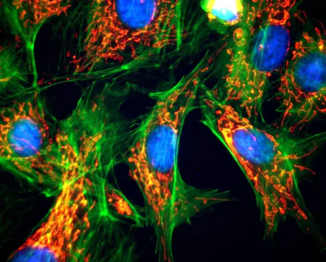 Fluorescence Arbitrary Units : 荧光任意单位