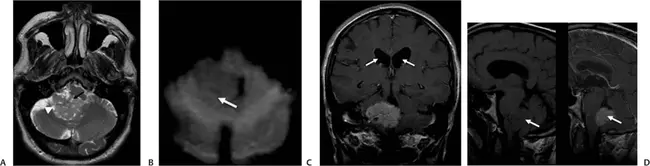 Current Problems in Diagnostic Radiology : 诊断放射学的当前问题