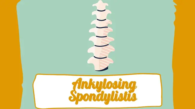 Ankylosing Spondylitis Disease Activity Score : 疾病活动性得分