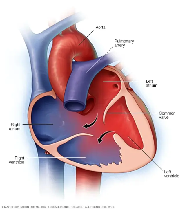 Atrioventricular : 房室