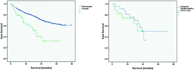 Trans‐myocardial Revascularization : 经心肌血运重建