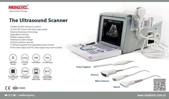 Ultrasound targeted microbubble destruction : 超声靶向微泡破坏