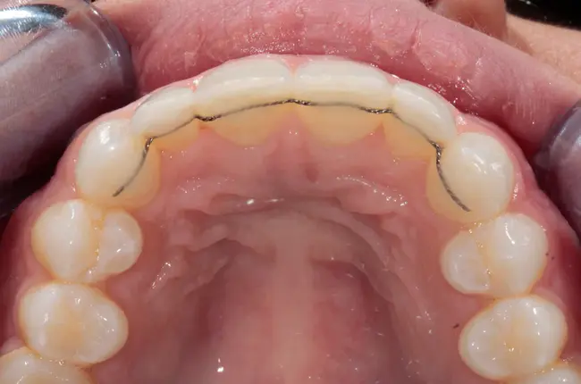 Oral Dental and Craniofacial Sciences : 口腔牙科和颅面科学