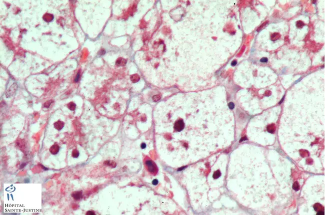 Hepatocyte nuclear factors : 肝细胞核因子