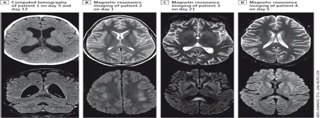 Pediatrics and Developmental Neuroscience Branch : 儿科与发育神经科学科