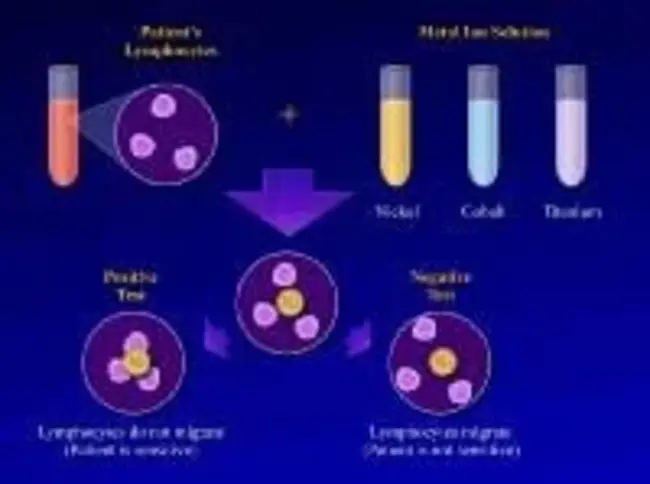 Lymphokine Activated Killer : 淋巴因子激活杀手