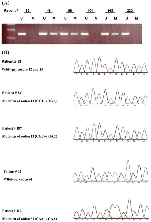 Physiological Cross Sectional Area : 生理横截面积